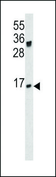 ANTI-IGJ(N-TERMINAL) antibody produced in rabbit