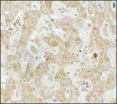 Anti-CCR7 antibody produced in rabbit