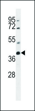 ANTI-SRD5A2L2 (C-TERM) antibody produced in