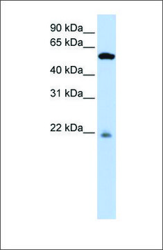 Anti-PM20D2 antibody produced in rabbit