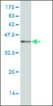 Monoclonal Anti-K6HF antibody produced in