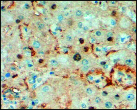 Anti-Triosephosphate Isomerase antibody produced in