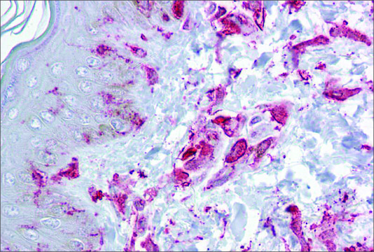 Anti-ZFP36L2 antibody produced in rabbit