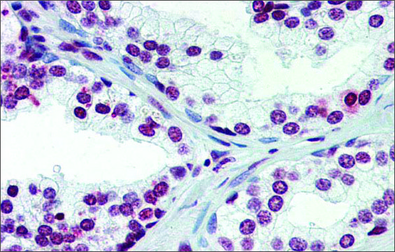 Anti-ARID5A (ab2) antibody produced in
