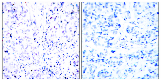Anti-Retinoblastoma, C-Terminal antibody produced in