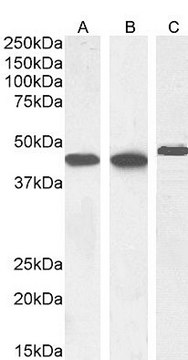 Anti-Smooth Muscle ?-Actin antibody produced