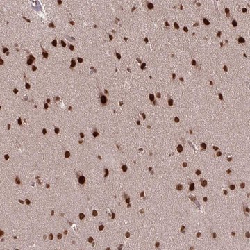 Anti-SS18 antibody produced in rabbit