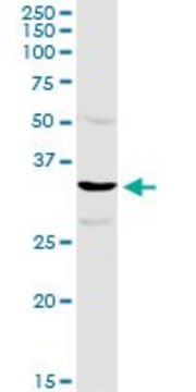 Anti-TTC1 antibody produced in rabbit