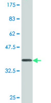 Monoclonal Anti-PLD1, (C-terminal) antibody produced