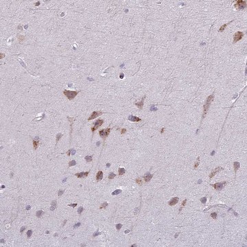 Anti-MAP7D2 antibody produced in rabbit