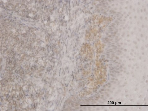 ANTI-FOXO3A antibody produced in mouse