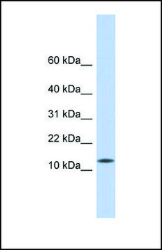 Anti-CDRT4 antibody produced in rabbit