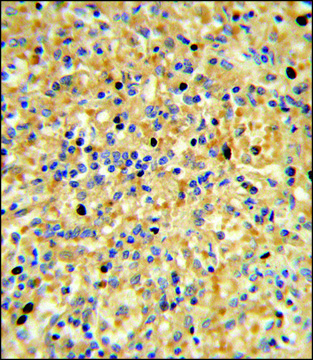 ANTI-CCDC3 (C-TERM) antibody produced in