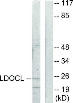 Anti-LDOC1L antibody produced in rabbit