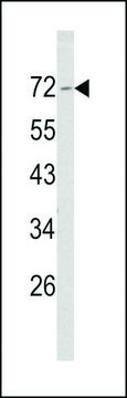 ANTI-MERLIN(N-TERMINAL) antibody produced in rabbit
