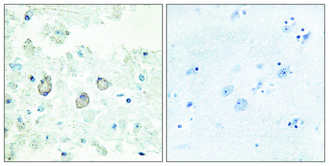 Anti-DOK7 antibody produced in rabbit