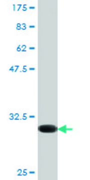 Monoclonal Anti-CX3CR1, (N-terminal) antibody produced