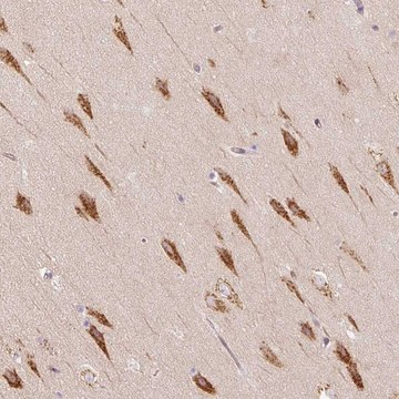 Anti-TBC1D2B antibody produced in rabbit