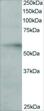 Anti-IRF6 antibody produced in goat