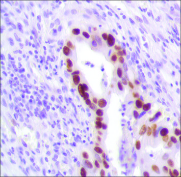 Anti-P53 antibody, Rabbit monoclonal