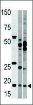 Anti-NCBP2 (N-term) antibody produced in