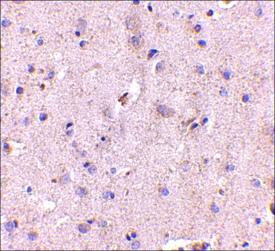 Anti-SAPAP2 antibody produced in rabbit