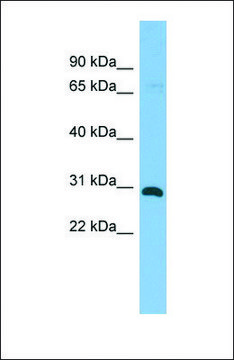 Anti-HHEX, (C-terminal) antibody produced in