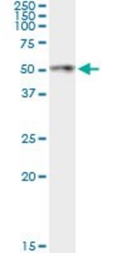 Monoclonal Anti-ANGPTL4, (C-terminal) antibody produced