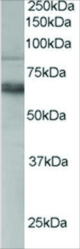 Anti-TEM8/Anthrax Toxin Receptor 1 antibody