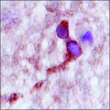 Anti-CPLX2, (N-terminal) antibody produced in