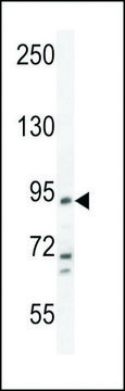 ANTI-FBXO39(C-TERMINAL) antibody produced in rabbit