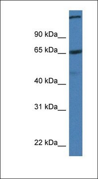 Anti-ST6GALNAC1 antibody produced in rabbit
