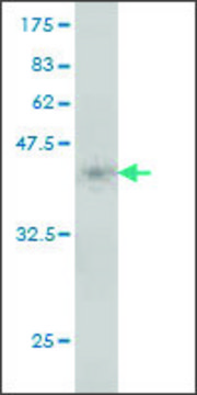 Monoclonal Anti-MTRR antibody produced in