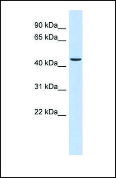 Anti-OGDH antibody produced in rabbit