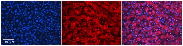 Anti-SLC26A3 antibody produced in rabbit
