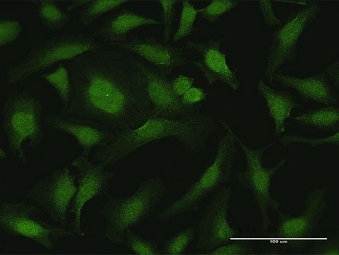 Anti-PSCD2 antibody produced in rabbit