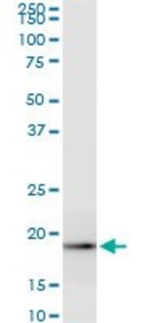 Monoclonal Anti-ICT1, (C-terminal) antibody produced