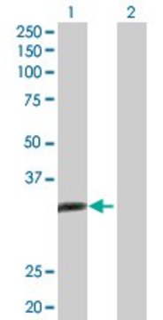 Anti-ALKBH3 antibody produced in rabbit