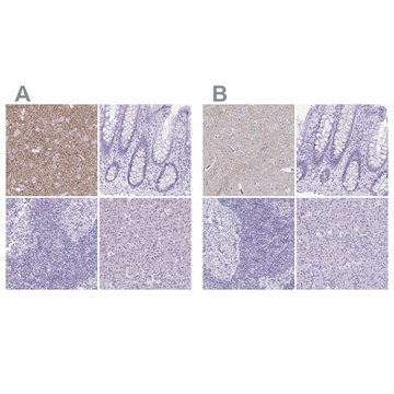 Anti-VGAT antibody produced in rabbit