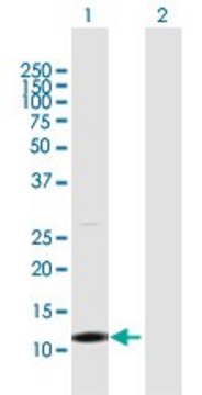 Anti-TCL1B antibody produced in rabbit