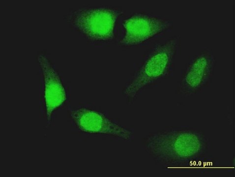 ANTI-FOXO1A antibody produced in mouse