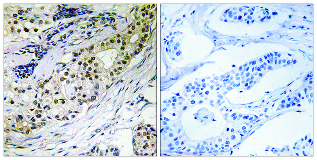 Anti-LAMA3 antibody produced in rabbit
