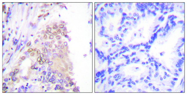 Anti-AML1 antibody produced in rabbit