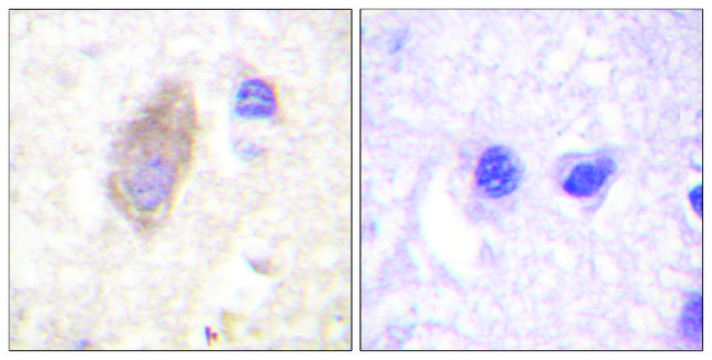 Anti-Rabphilin 3A antibody produced in