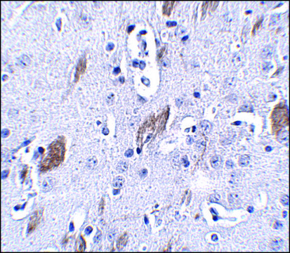 Anti-ATOH8 antibody produced in rabbit