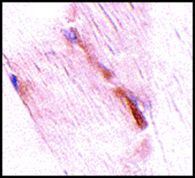 Anti-NIPSNAP2 (ab2) antibody produced in