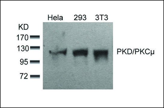 Anti-PRKD1 (Ab-910) antibody produced in