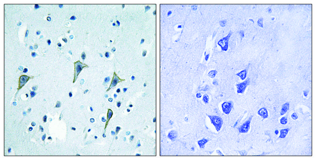 Anti-GPR85 antibody produced in rabbit