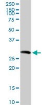 Anti-SGCG antibody produced in rabbit