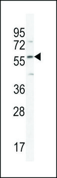 ANTI-DMP4(C-TERMINAL) antibody produced in rabbit